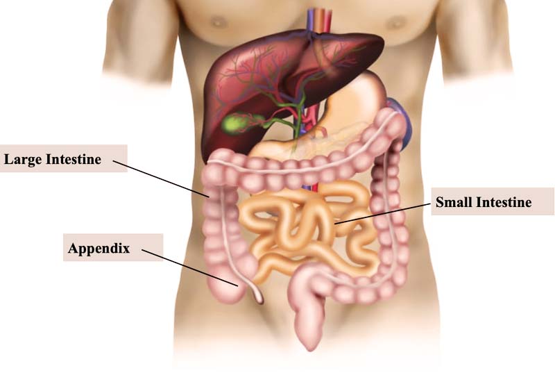 Laparoscopic Appendix