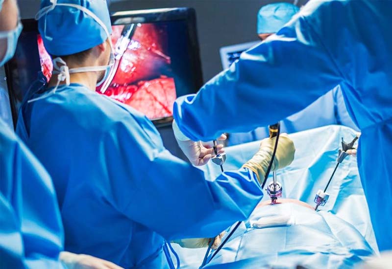 Laparoscopic Hysterectomy