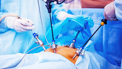 surgery